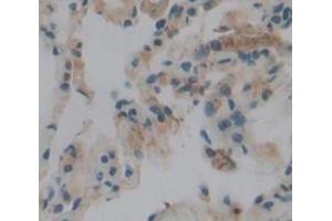 IHC-P analysis of Human Tissue, with DAB staining. (PLA2G4A Antikörper  (AA 1-178))