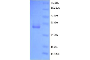 SDS-PAGE (SDS) image for Epidermal Growth Factor (EGF) (AA 977-1023), (partial) protein (GST tag) (ABIN5712461)