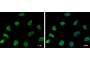 ICC/IF Image DNAJB6 antibody [N3C3] detects DNAJB6 protein at nucleus by immunofluorescent analysis. (DNAJB6 Antikörper  (Center))
