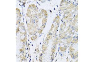 Immunohistochemistry of paraffin-embedded human stomach using FANCA antibody at dilution of 1:100 (x40 lens).