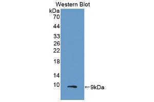 Western blot analysis of the recombinant protein. (CXCL2 Antikörper  (AA 34-107))