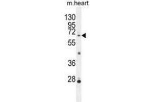 Western blot analysis in mouse heart tissue lysates (35ug/lane) using NKPD1  Antibody (C-term). (NKPD1 Antikörper  (C-Term))