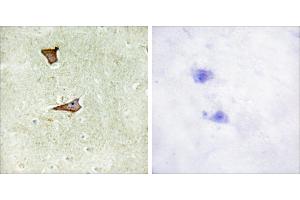 Immunohistochemistry analysis of paraffin-embedded human brain tissue using IGF2R (Phospho-Ser2409) antibody. (IGF2R Antikörper  (pSer2409))