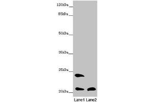 Western blot All lanes: MSRB3 antibody at 8. (MSRB3 Antikörper  (AA 1-185))