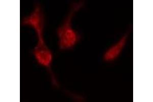 ABIN6277519 staining  Hela cells by IF/ICC. (PRKACB Antikörper  (C-Term))