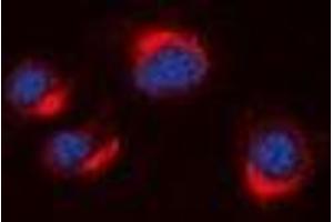 Immunofluorescent analysis of VN1R2 staining in A549 cells.