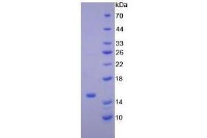 Image no. 1 for Natriuretic Peptides B (NPPB) (AA 27-121) protein (His tag) (ABIN6239845)