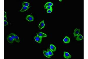 Immunofluorescent analysis of A375 cells using ABIN7149074 at dilution of 1:100 and Alexa Fluor 488-congugated AffiniPure Goat Anti-Rabbit IgG(H+L) (CysLTR1 Antikörper  (AA 298-337))