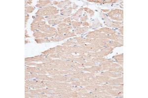 Immunohistochemistry of paraffin-embedded rat heart using ABCC5 antibody (ABIN6291734) at dilution of 1:100 (40x lens). (ABCC5 Antikörper)