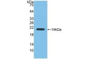 Detection of Recombinant MMP9, Rat using Polyclonal Antibody to Matrix Metalloproteinase 9 (MMP9) (MMP 9 Antikörper  (AA 226-391))