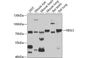 Western blot analysis of extracts of various cell lines, using FBXL5 antibody (ABIN6130378, ABIN6140510, ABIN6140511 and ABIN6221239) at 1:1000 dilution. (FBXL5 Antikörper  (AA 1-310))