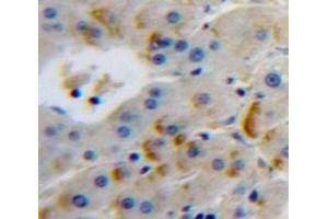 Used in DAB staining on fromalin fixed paraffin-embedded Liver tissue (FURIN Antikörper  (AA 385-500))