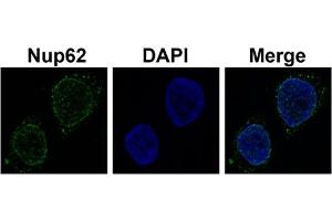 Sample Type :  Hela cell lysate (NUP62 Antikörper  (N-Term))