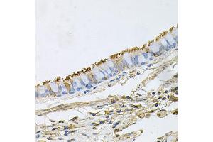 Immunohistochemistry of paraffin-embedded human lung using HSP90AA1 antibody (ABIN6292998) at dilution of 1:100 (40x lens). (HSP90AA1 Antikörper)
