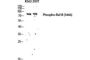 Western Blot (WB) analysis of K562 293T lysis using Phospho-Raf-B (S446) antibody. (BRAF Antikörper  (pSer446))