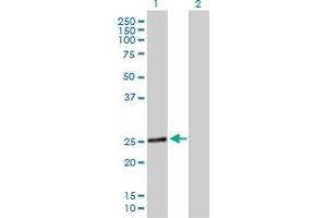 Western Blot analysis of RAB28 expression in transfected 293T cell line by RAB28 MaxPab polyclonal antibody. (RAB28 Antikörper  (AA 1-221))