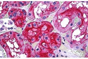 Human Kidney, Tubules: Formalin-Fixed, Paraffin-Embedded (FFPE) (GGT1 Antikörper  (AA 381-471))
