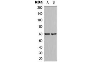 Western blot analysis of CCDC102B expression in HepG2 (A), NIH3T3 (B) whole cell lysates.
