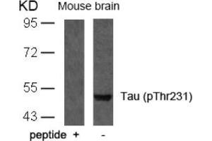 Image no. 1 for anti-Microtubule-Associated Protein tau (MAPT) (pThr231) antibody (ABIN196807) (MAPT Antikörper  (pThr231))