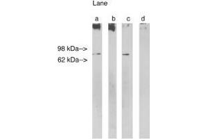 Image no. 1 for anti-Ceramide Synthase 1 (CERS1) antibody (ABIN265223) (LASS1 Antikörper)