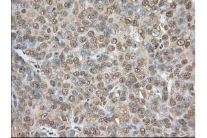 Immunohistochemical staining of paraffin-embedded Human colon tissue using anti-PDE4A mouse monoclonal antibody. (PDE4A Antikörper)