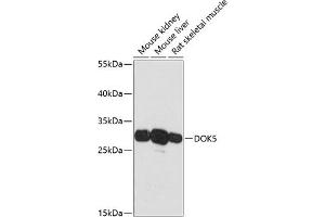 Western blot analysis of extracts of various cell lines, using DOK5 antibody (ABIN6127774, ABIN6139769, ABIN6139770 and ABIN6217826) at 1:3000 dilution. (DOK5 Antikörper  (AA 237-306))