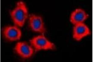 Immunofluorescent analysis of CDK15 staining in HepG2 cells. (Cyclin-Dependent Kinase 15 (ALS2CR7) Antikörper)