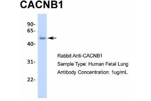 Host:  Rabbit  Target Name:  CACNB1  Sample Type:  Human Fetal Lung  Antibody Dilution:  1. (CACNB1 Antikörper  (N-Term))