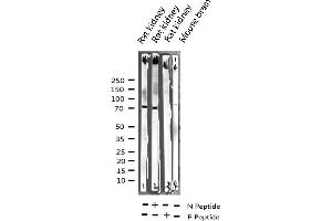 Western blot analysis of Phospho-C-RAF (Ser259) expression in various lysates (RAF1 Antikörper  (pSer259))