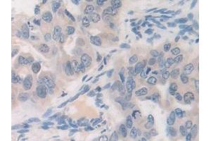 Immunohistochemistry (IHC) image for anti-Farnesyl-Diphosphate Farnesyltransferase 1 (FDFT1) (AA 269-417) antibody (ABIN7433993)