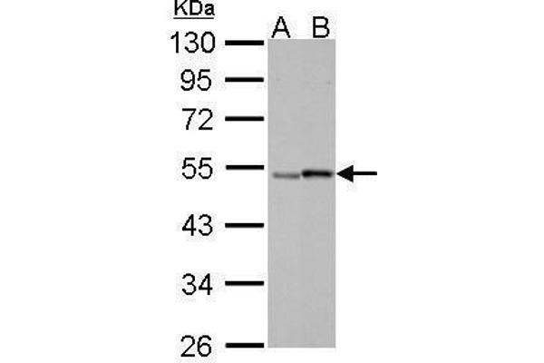 Retinoic Acid Receptor gamma Antikörper