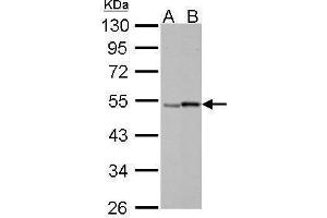 WB Image Retinoic Acid Receptor gamma antibody detects RARG protein by Western blot analysis. (Retinoic Acid Receptor gamma Antikörper)