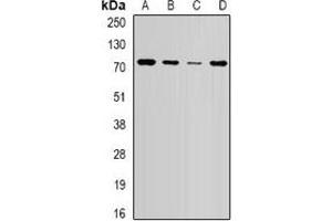 Western blot analysis of NSD2 expression in HepG2 (A), SW620 (B), mouse brain (C), mouse spleen (D) whole cell lysates. (WHSC1 Antikörper)