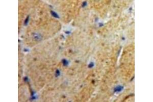 Used in DAB staining on fromalin fixed paraffin-embedded Heart tissue (MSE Antikörper  (AA 3-434))