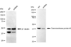Western blotting analysis using Transmembrane protein 43 antibody (ABIN7800622).
