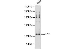 Western blot analysis of extracts of HeLa cells, using  antibody (ABIN6129704, ABIN6136903, ABIN6136905 and ABIN6216979) at 1:3000 dilution. (Anoctamin 2 Antikörper  (AA 1-200))