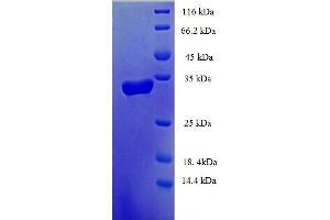 SDS-PAGE (SDS) image for Chromosome 14 Open Reading Frame 126 (C14orf126) (AA 1-168), (full length) protein (His-SUMO Tag) (ABIN4974369) (C14orf126 Protein (AA 1-168, full length) (His-SUMO Tag))