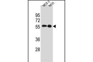 SRC Antibody (N-term) A western blot analysis in MCF-7,A431 cell line lysates (35 μg/lane). (Src Antikörper  (N-Term))