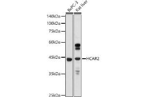 Western blot analysis of extracts of various cell lines, using GPR109A/HM74A/HC antibody (ABIN7267804) at 1:1000 dilution. (HCAR2 Antikörper  (AA 250-350))