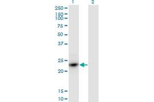 Western Blot analysis of HDGFRP3 expression in transfected 293T cell line by HDGFRP3 monoclonal antibody (M02), clone 1D1.
