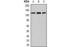 Western blot analysis of Nucleolin expression in MCF7 (A), A549 (B), THP1 (C) whole cell lysates. (Nucleolin Antikörper)