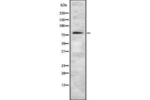 Western blot analysis of MTF1 using Jurkat whole cell lysates (MTF1 Antikörper  (Internal Region))