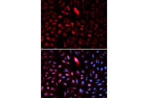 Immunofluorescence analysis of U2OS cells using TCP1 antibody (ABIN5971010). (TCP1 alpha/CCTA Antikörper)