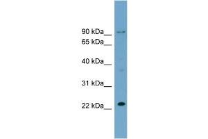 WB Suggested Anti-C15orf15  Antibody Titration: 0.