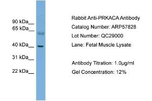 WB Suggested Anti-PRKACA  Antibody Titration: 0. (PRKACA Antikörper  (N-Term))