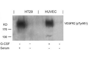Western blot analysis of extracts from G-CSF-treated HUVEC and serum-treated HT29 cells using VEGFR2(Phospho-Tyr951) Antibody. (VEGFR2/CD309 Antikörper  (pTyr951))