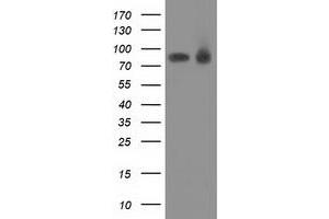 Western Blotting (WB) image for anti-Protein Kinase C, epsilon (PRKCE) antibody (ABIN1500230) (PKC epsilon Antikörper)