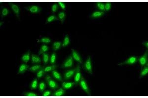 Immunofluorescence analysis of HeLa cells using SETMAR Polyclonal Antibody