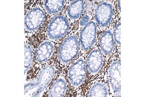 Immunohistochemistry (IHC) image for anti-Vimentin (VIM) (AA 325-375) antibody (ABIN7449539) (Rekombinanter Vimentin Antikörper  (AA 325-375))
