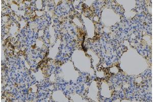 ABIN6275217 at 1/100 staining Mouse lung tissue by IHC-P. (Macrophage Mannose Receptor 1 Antikörper  (Internal Region))